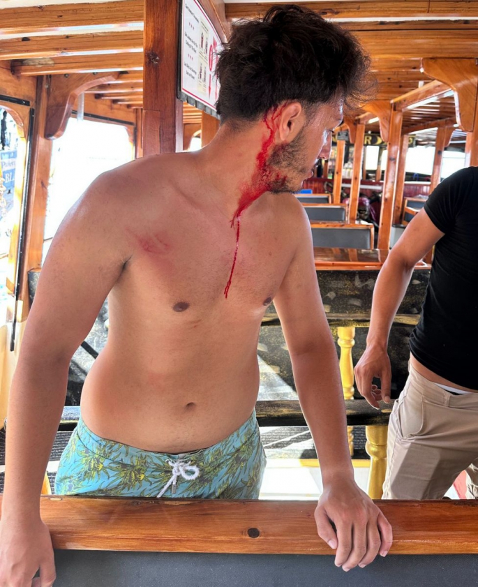 Suriyeliler bıçakla tekne çalışanlarına saldırdı 2 kişiyi  yaraladı