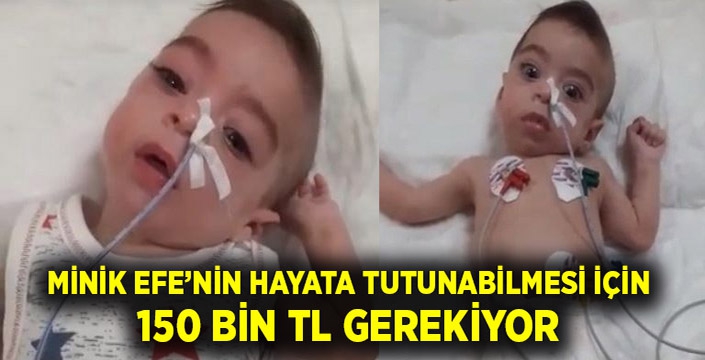 Minik Efe’nin hayata tutunabilmesi için 150 bin TL gerekiyor