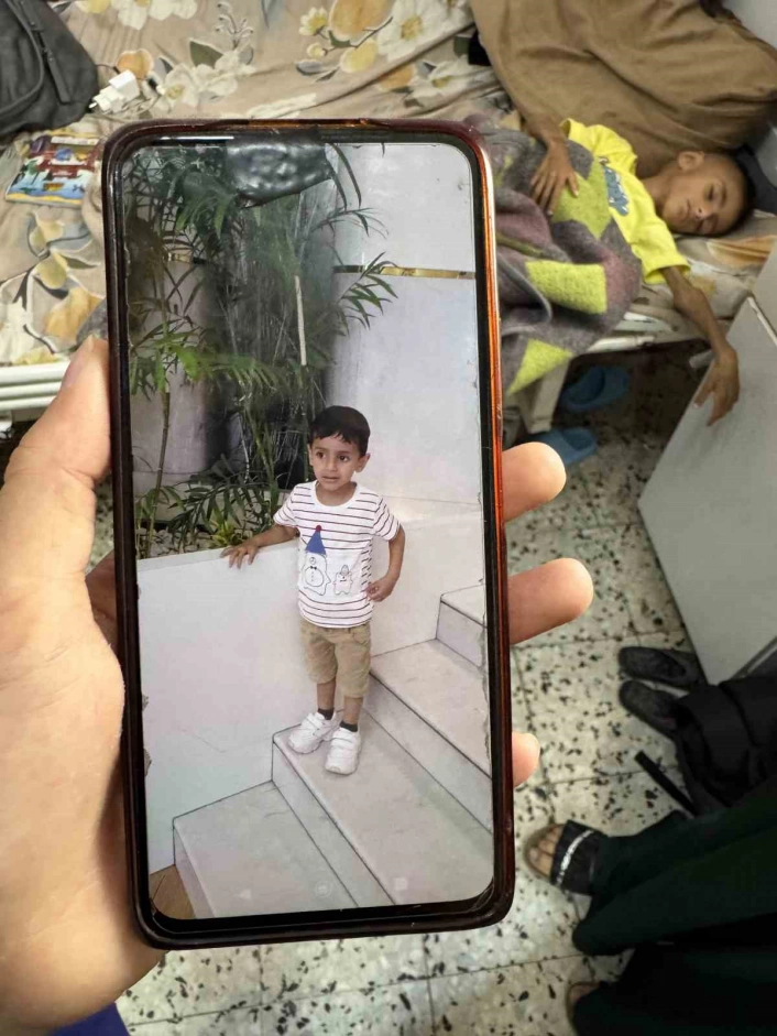 UNICEF Gazzede yetersiz beslenen 5 yaşındaki bir çocuğun İsrail saldırıları öncesi ve sonrasına ait fotoğraflarını paylaştı
